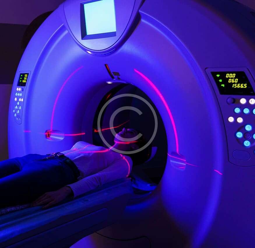 MRI scan